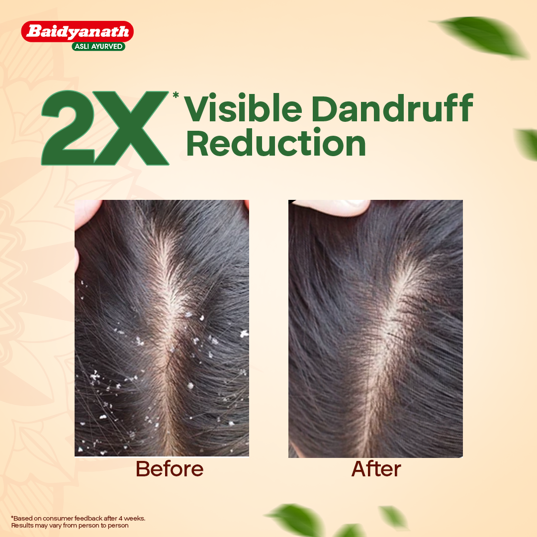 Baidyanath Curry Leaves Hair Oil - 200ml